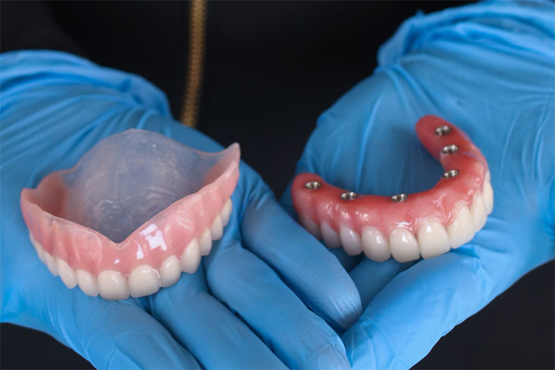 Fast-Fit Full Denture