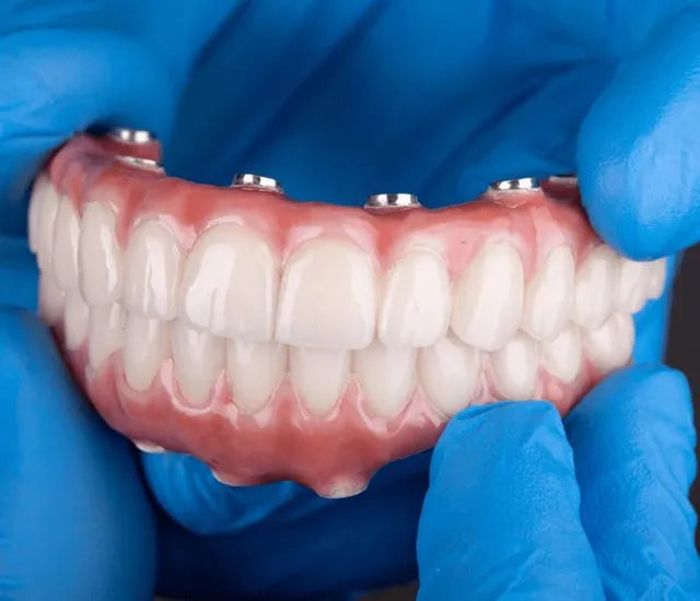 Fast-Fit Full Denture